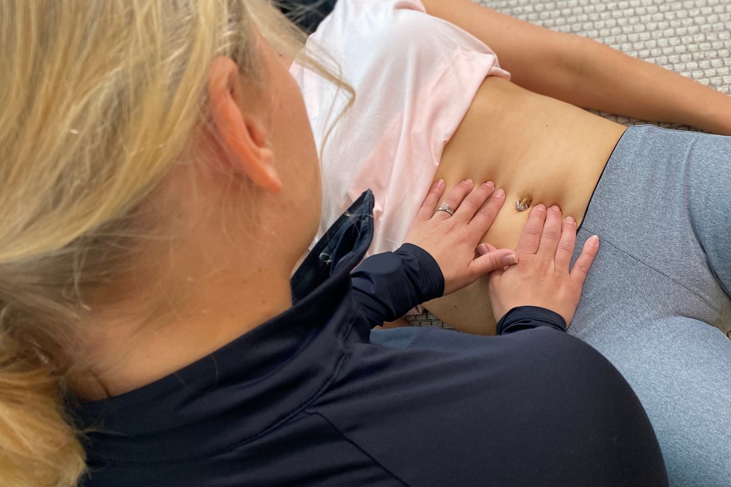 Vatsalihasten erkauma synnytyksen jälkeen